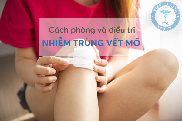 nhiem_trung_vet_mo nhiễm trùng vết mổ