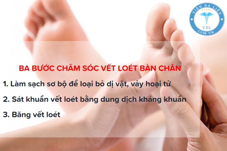 loet-ban-chan-tieu-duong loét bàn chân tiểu đường