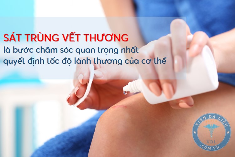 vet-thuong-ho vết thương hở