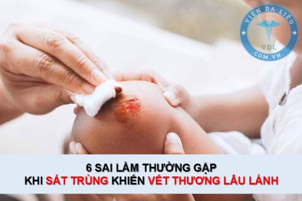 6 sai lầm thường gặp khi sát trùng khiến vết thương lâu lành 6 sai lầm thường gặp khi sát trùng khiến vết thương lâu lành