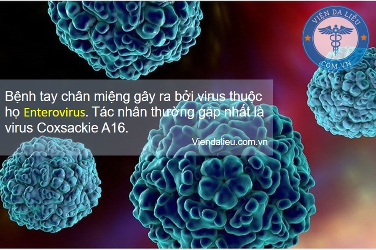 tay chân miệng
