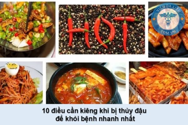 Thủy đậu kiêng gì? – 10 điều cần lưu ý để khỏi bệnh nhanh nhất Thủy đậu kiêng gì? – 10 điều cần lưu ý để khỏi bệnh nhanh nhất