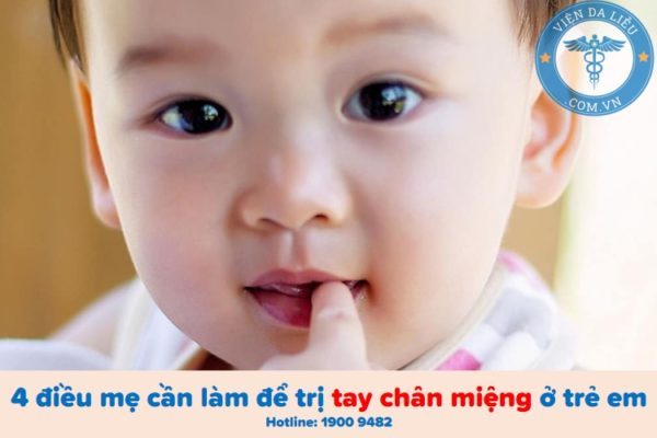 Bốn cách trị bệnh tay chân miệng ở trẻ em an toàn và hiệu quả Bốn cách trị bệnh tay chân miệng ở trẻ em an toàn và hiệu quả