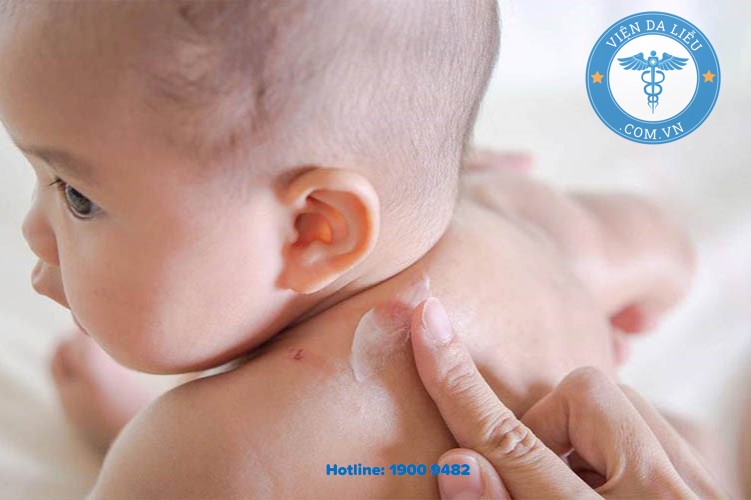 II. Kem em bé có tác dụng gì trong trị hăm da cho trẻ? 1